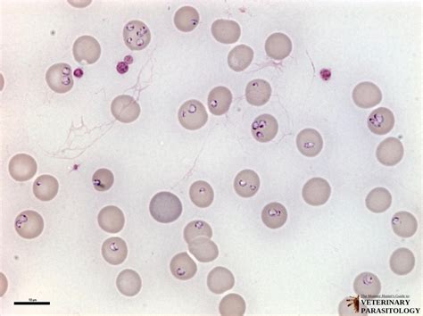  Babesia! Parazitik Bir Protozoonun Gizemli Dünyasına Yolculuk