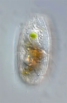  Coleps! Can This Tiny Ciliate Challenge a Mighty Whale for Microscopic Dominance?