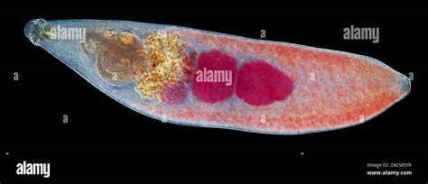  İdiopathic Flukes: How These Tiny Flatworms Can Send Your Ducks Quacking Mad!