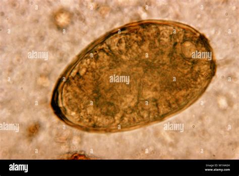  Japanese Lung Fluke: Can This Parasitic Worm Survive a Lifetime Inside Your Lungs?