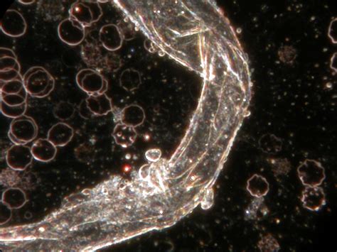  Mikrosporidium! Bu Küçük Parazitin Gizemli Dünyasına Yolculuk